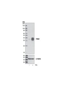 Cell Signaling Fra1 (D80b4) Rabbit mAb