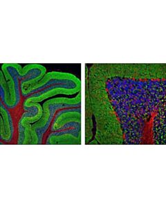 Cell Signaling Synapsin-1 (D12g5) Xp Rabbit mAb