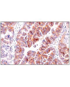Cell Signaling Semaphorin-4d/Cd100 (E5c3b) Xp Rabbit mAb