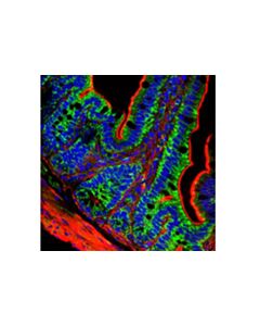 Cell Signaling Aif (D39d2) Xp Rabbit mAb