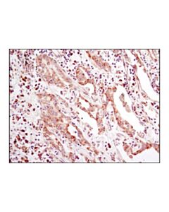 Cell Signaling Eif2alpha (D7d3) Xp Rabbit mAb