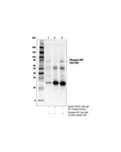 Cell Signaling Phospho-Rip (Ser166) (E7g6o) Rabbit mAb