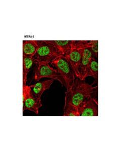 Cell Signaling Jmjd2a (C37e5) Rabbit mAb