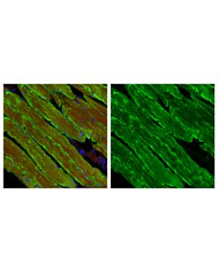 Cell Signaling Desmin (D93f5) Xp Rabbit mAb