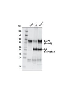 Cell Signaling Foxp2 (D55h9) Rabbit mAb