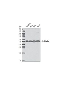 Cell Signaling Beta-Tubulin (9f3) Rabbit mAb (Hrp Conjugate)
