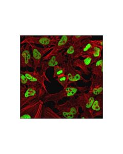 Cell Signaling Hdac1 (10e2) Mouse mAb