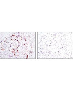 Cell Signaling Phospho-S6 Ribosomal Protein (Ser240/244) (D68f8) Xp Rabbit mAb