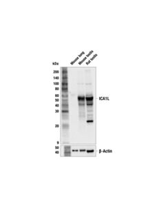 Cell Signaling ICA1L (F6I4E) Rabbit mAb 100 uL