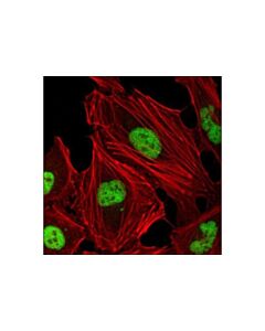 Cell Signaling Jmjd1b (6a1-1f5) Mouse mAb