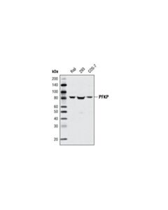 Cell Signaling Pfkp Antibody