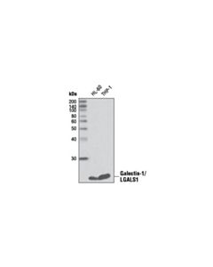 Cell Signaling Galectin-1/Lgals1 Antibody