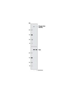 Cell Signaling Phospho-Talin (Ser425) Antibody