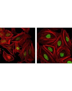 Cell Signaling Foxm1 (D12d5) Xp Rabbit mAb