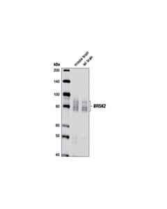 Cell Signaling Brsk2 (D29b6) Rabbit mAb