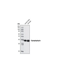 Cell Signaling Synaptophysin (D35e4) Rabbit mAb