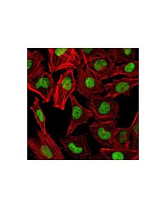 Cell Signaling Chaf1a (D77d5) Xp Rabbit mAb