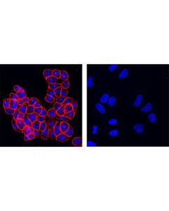 Cell Signaling Epcam (Vu1d9) Mouse mAb (Alexa Fluor<LT/>Sup&Gt;®<LT/>/Sup&Gt; 555 Conjugate)