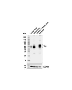 Cell Signaling Tau (E8B5J) Mouse mAb 20 uL