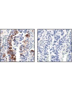 Cell Signaling Phospho-Mtor (Ser2448) (49f9) Rabbit mAb (Ihc Specific) (BSA And Azide Free)
