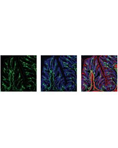 Cell Signaling Vista (D5l5t) Xp Rabbit mAb
