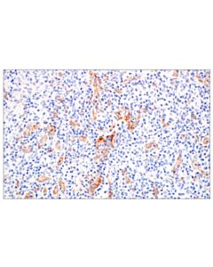Cell Signaling Cd93/C1qr (E5h9b) Rabbit mAb
