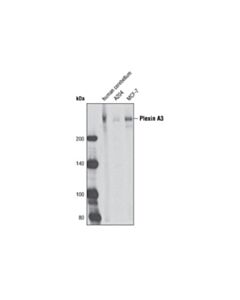Cell Signaling Plexin A3 (D2g12) Rabbit mAb