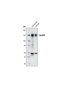 Cell Signaling Syngap (D78b11) Rabbit mAb