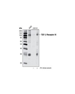Cell Signaling Tgf-Beta Receptor Iii (D11g10) Rabbit mAb