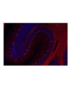 Cell Signaling β3-Tubulin (D65A4) XP® Rabbit mAb (Alexa Fluor® 647 Conjugate); 100 µl