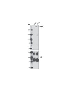 Cell Signaling Lrrk2 Antibody
