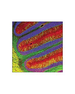 Cell Signaling Beta3-Tubulin (D71g9) Xp Rabbit mAb