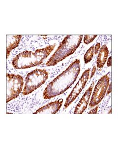 Cell Signaling Epcam (D9s3p) Rabbit mAb (Ihc Preferred) (BSA And Azide Free)