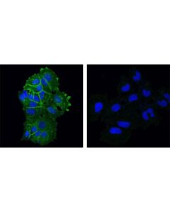 Cell Signaling Ddr1 (D1g6) Xp Rabbit mAb