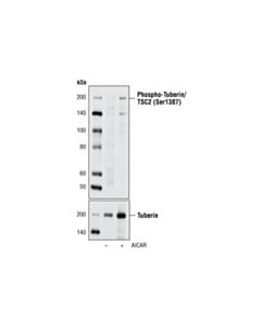 Cell Signaling Phospho-Tuberin/Tsc2 (Ser1387) Antibody