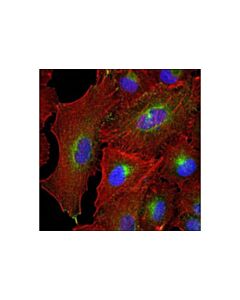 Cell Signaling Rab11 (D4f5) Xp Rabbit mAb
