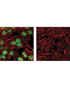 Cell Signaling C-Myc (D84c12) Rabbit mAb