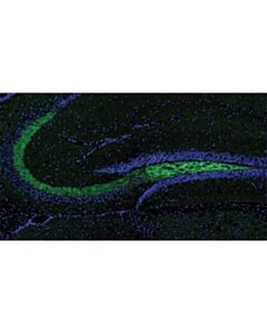 Cell Signaling Bace (D10e5) Rabbit mAb