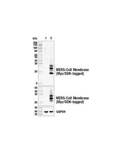 Cell Signaling Mers-Cov Membrane Protein (E2z4q) Rabbit mAb
