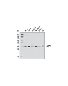 Cell Signaling Arp2 (D85d5) Rabbit mAb