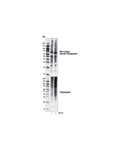 Cell Signaling K63-Linkage Specific Polyubiquitin (D7a11) Rabbit mAb