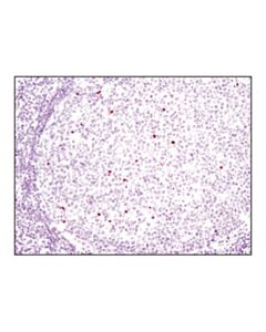 Cell Signaling Cleaved Parp (Asp214) (D64e10) Xp Rabbit mAb