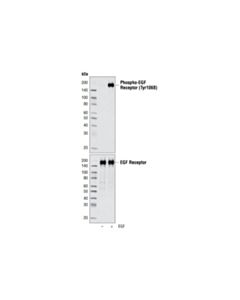 Cell Signaling Egf Receptor Control Cell Extracts