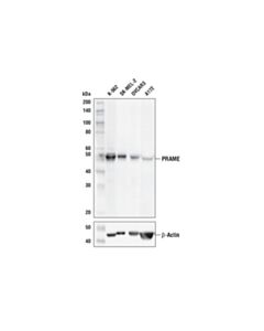 Cell Signaling Prame (E7i1b) Rabbit mAb
