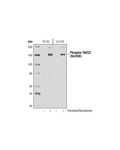 Cell Signaling Phospho-Tacc3 (Ser558) Antibody