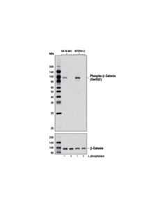Cell Signaling Phospho-Beta-Catenin (Ser552) (D8e11) Rabbit mAb