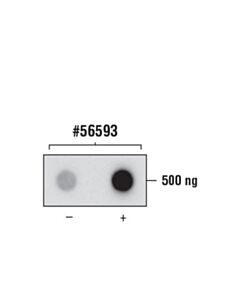 Cell Signaling N6-Methyladenosine (M6a) (D9d9w) Rabbit mAb