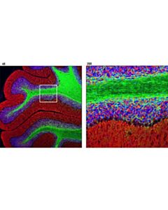 Cell Signaling Cnpase (D83e10) Xp Rabbit mAb