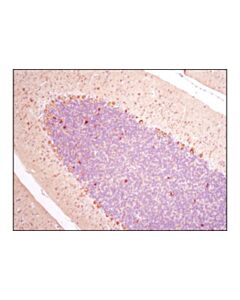 Cell Signaling Beta3-Tubulin (D65a4) Xp Rabbit mAb
