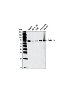 Cell Signaling Dyrk1b (D40d1) Rabbit mAb